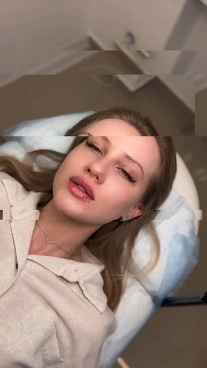 Preenchimento labial