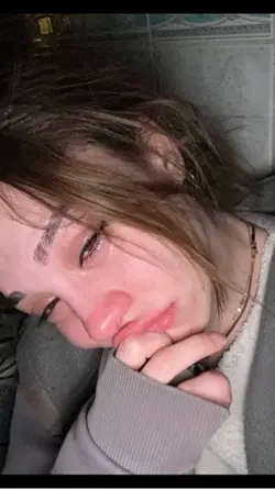 Canım acıyor benim