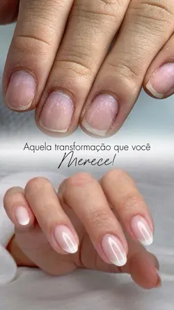 Antes e depois nail 