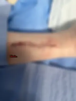 ‼️TW BLOOD⚠️‼️