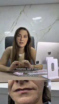 Preenchimento labial