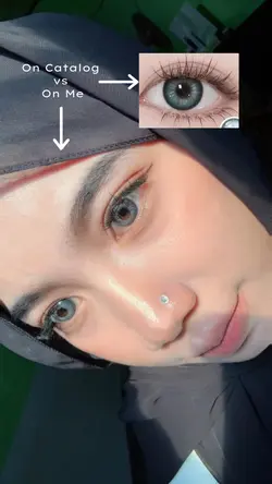 Review softlens