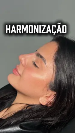 Harmonização facial