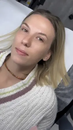 Rzęsy