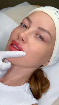 TRANSITION LIP 💋