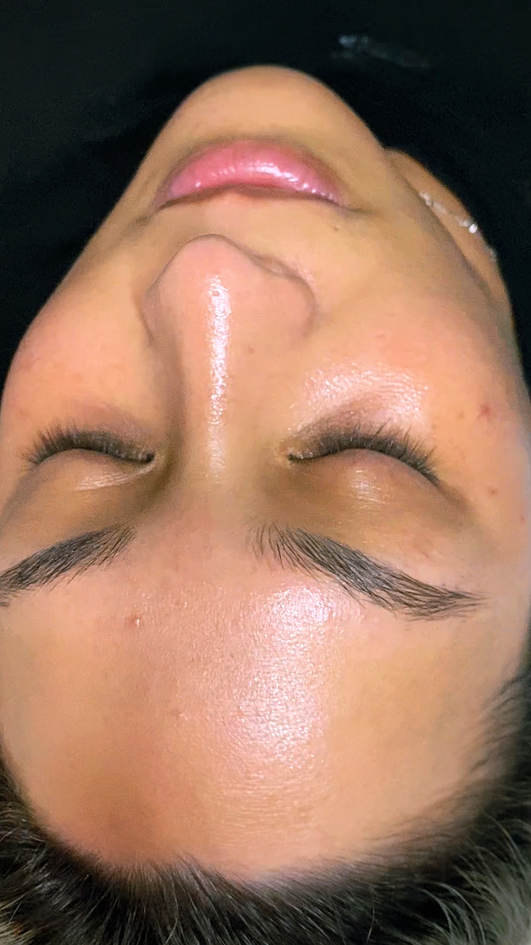 Limpieza facial 