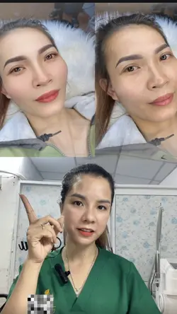 Cách chỉnh hình