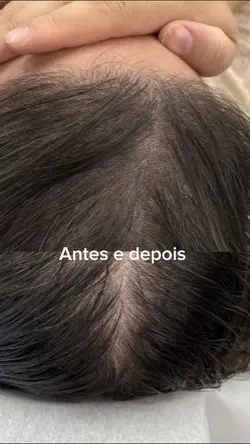 Antes e depois