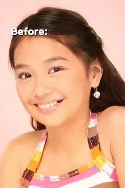 before & after trend