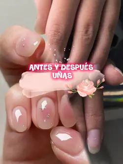 Antes y Después Uñas