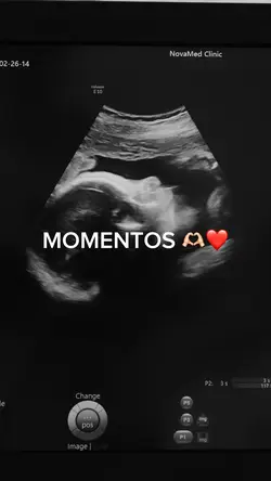 Momentos maternidade