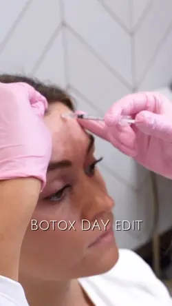 Botox day