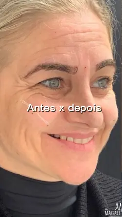 Antes e depois 