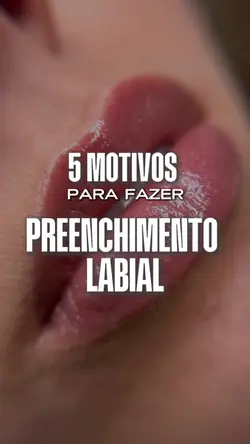 Preenchimento labial