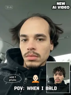BALD 