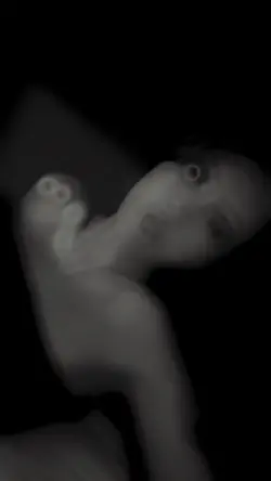 Viral