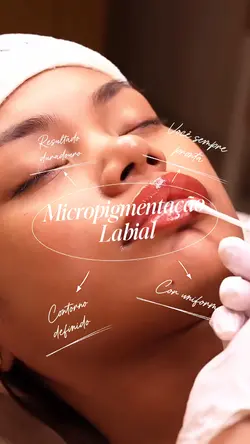 Micro labial