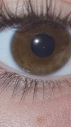 eye filter