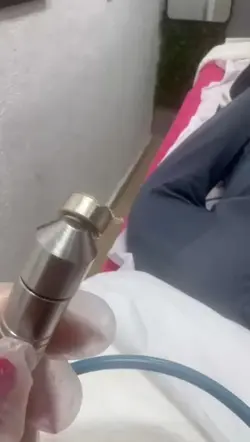 Peeling diamante 