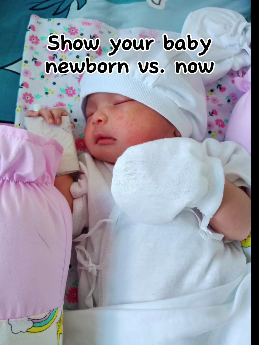 Recién nacido vs.now
