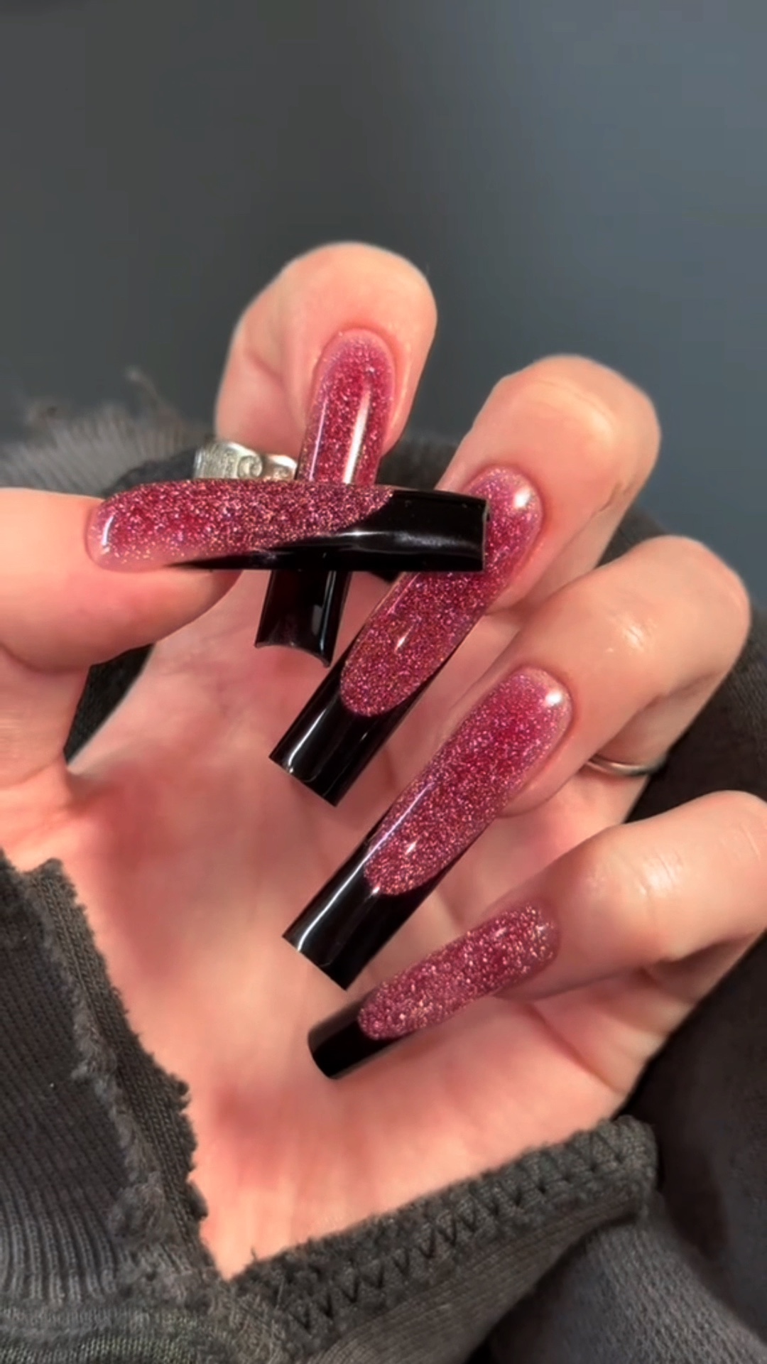 Ongle