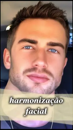 harmonização facial
