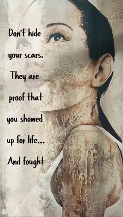 Scars