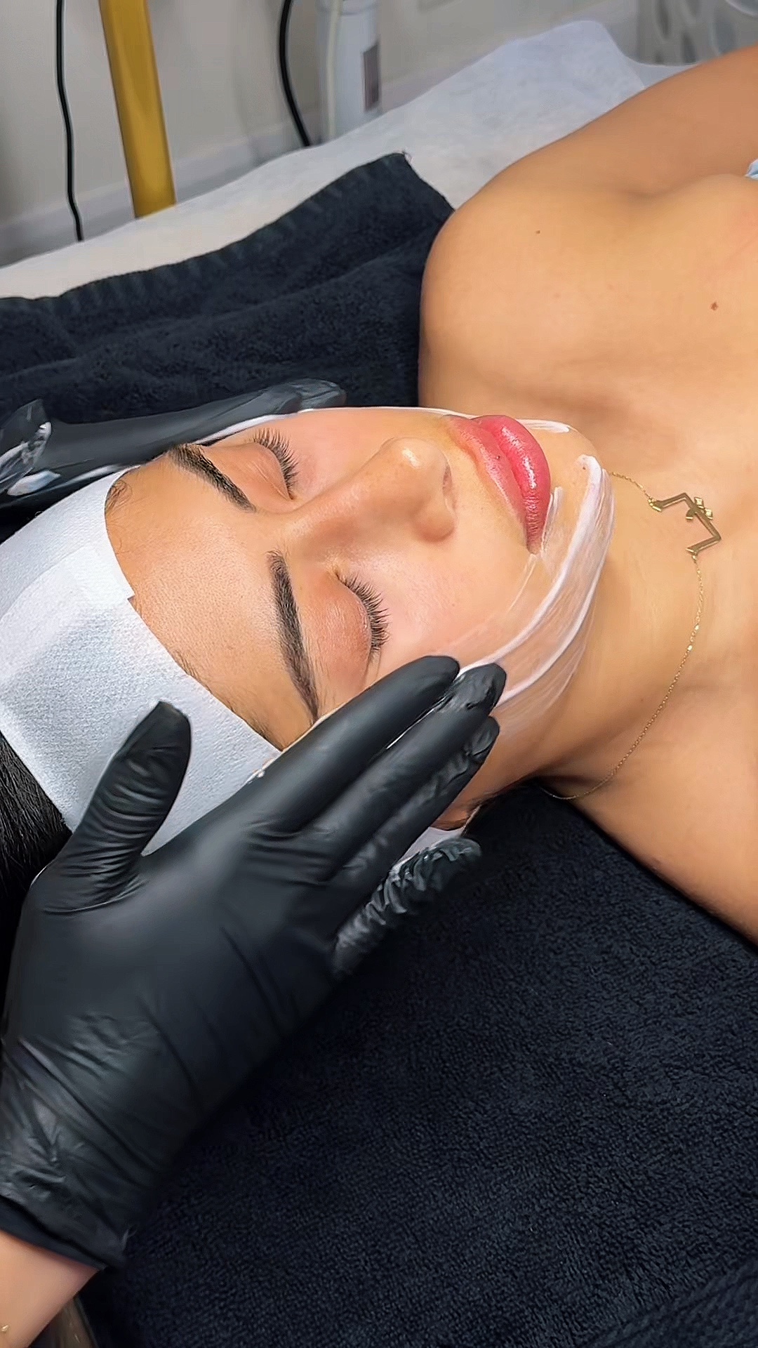 Facial