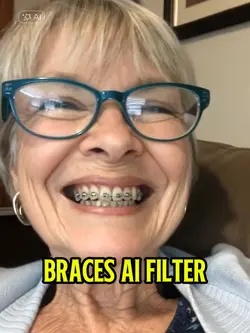 Braces Ai Filter