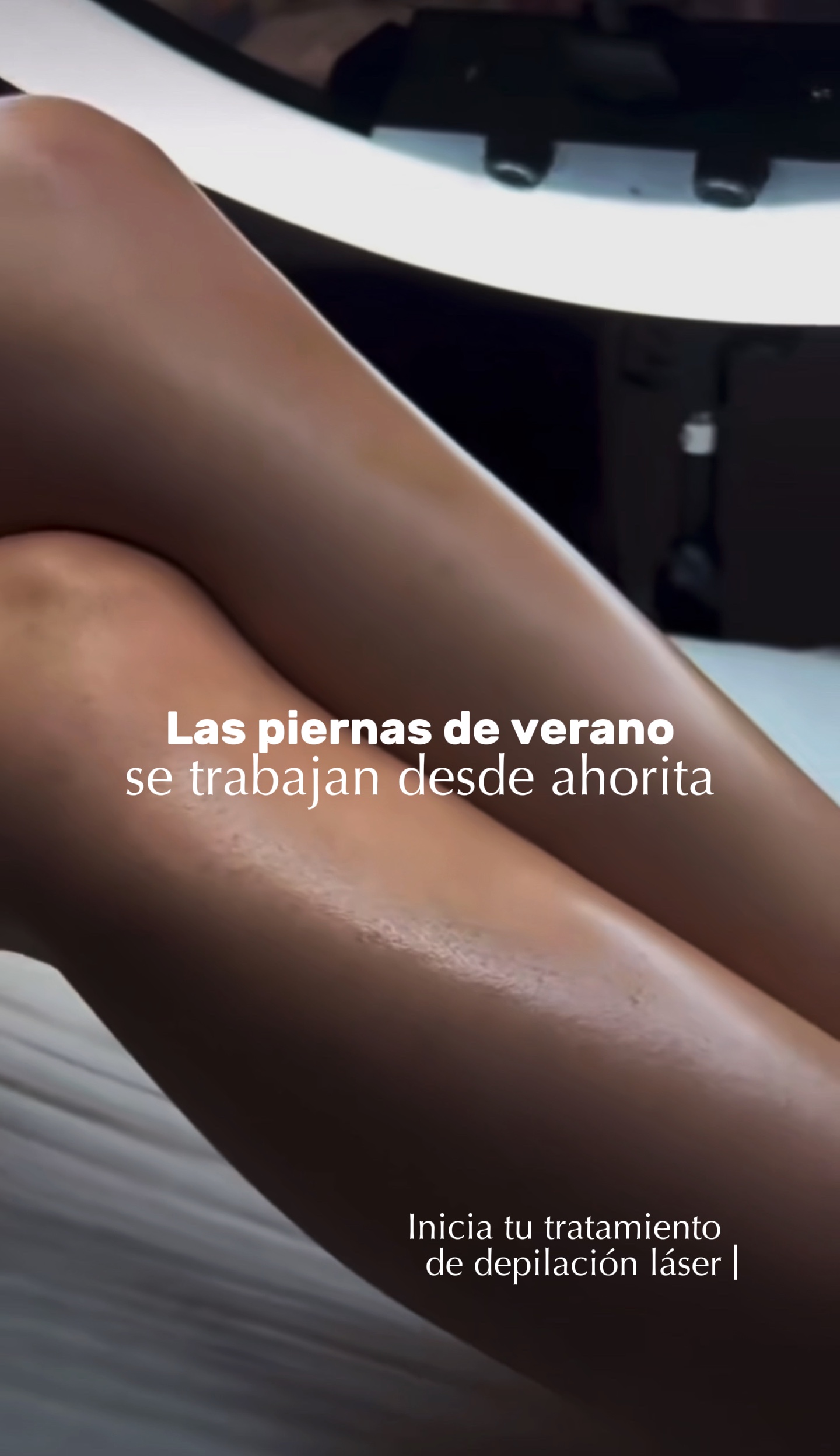 Depilación láser