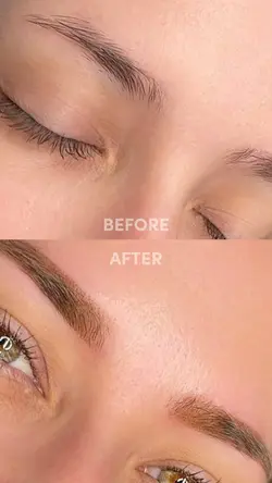 Before After Brows