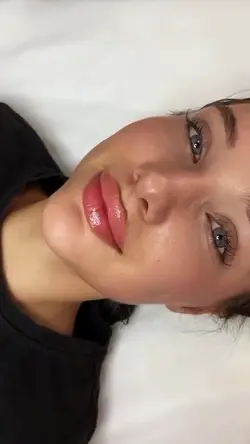 Lip filler
