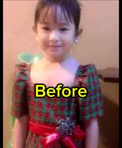 Before and After