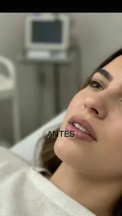 #beforeandafter #permanentmakeup #lipblush #makeup #beauty