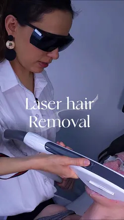 Laser hair removal