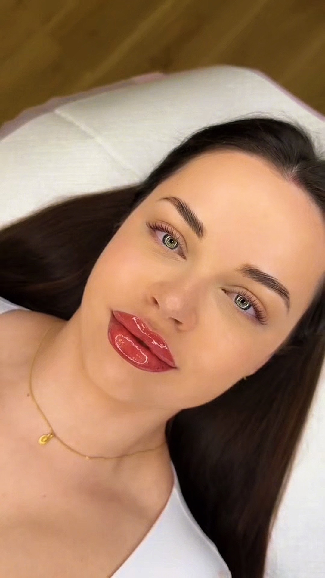 Lip filler