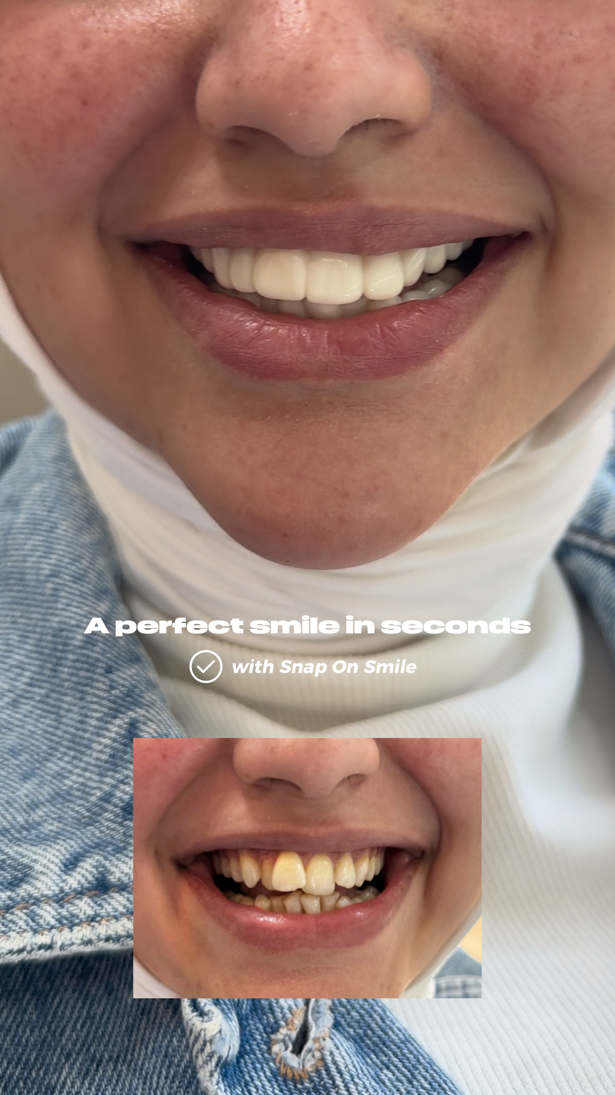 dental before&after