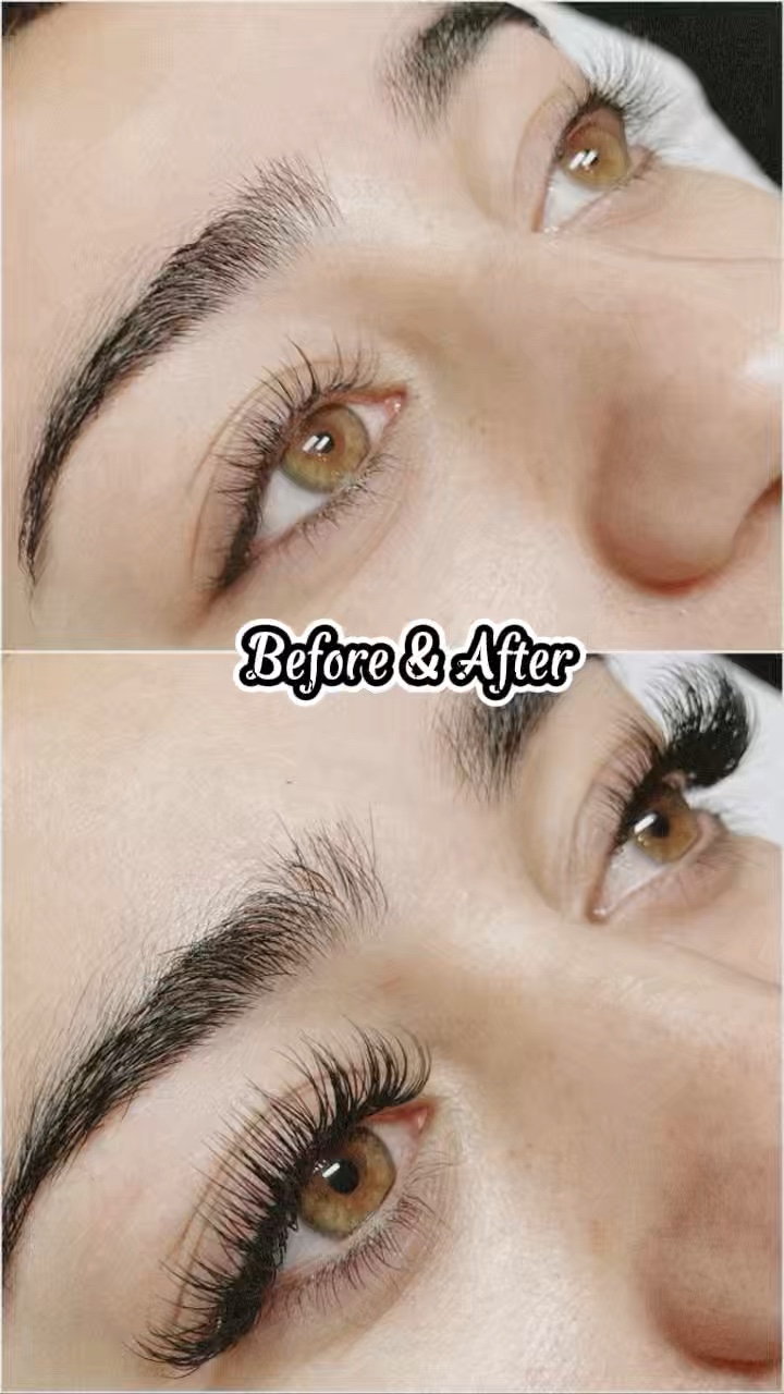 Olho antes e depois