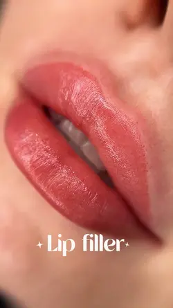 Lip filler 