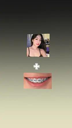 brace