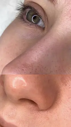 Antes e depois