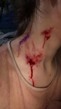 ai wounds prank