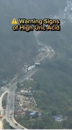 High uric aci