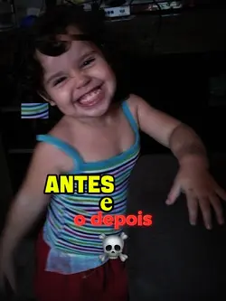 antes e o depois