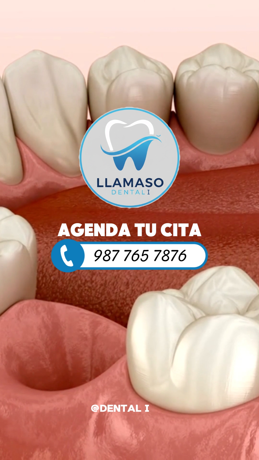 CÁRIES DENTISTA