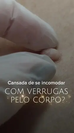 Jato de Plasma