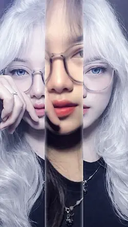 albino trend
