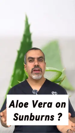 Aloe vera sunburn
