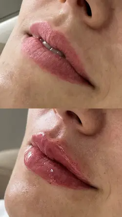BEFORE X AFTER