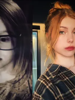 before after